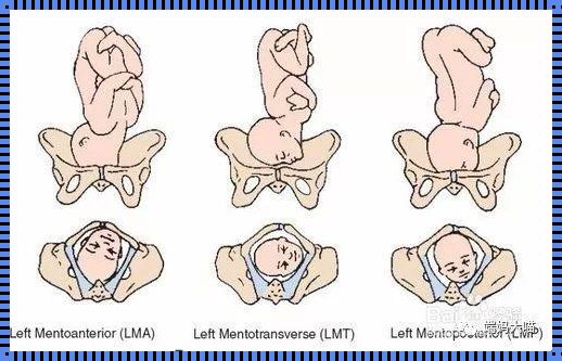 孕期LS胎位揭秘：多少周惊现“乾坤大挪移”