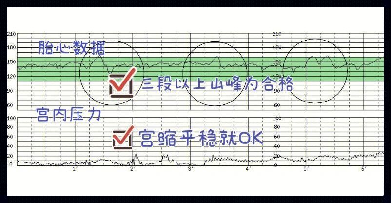 32周胎心监护不过关怎么办？