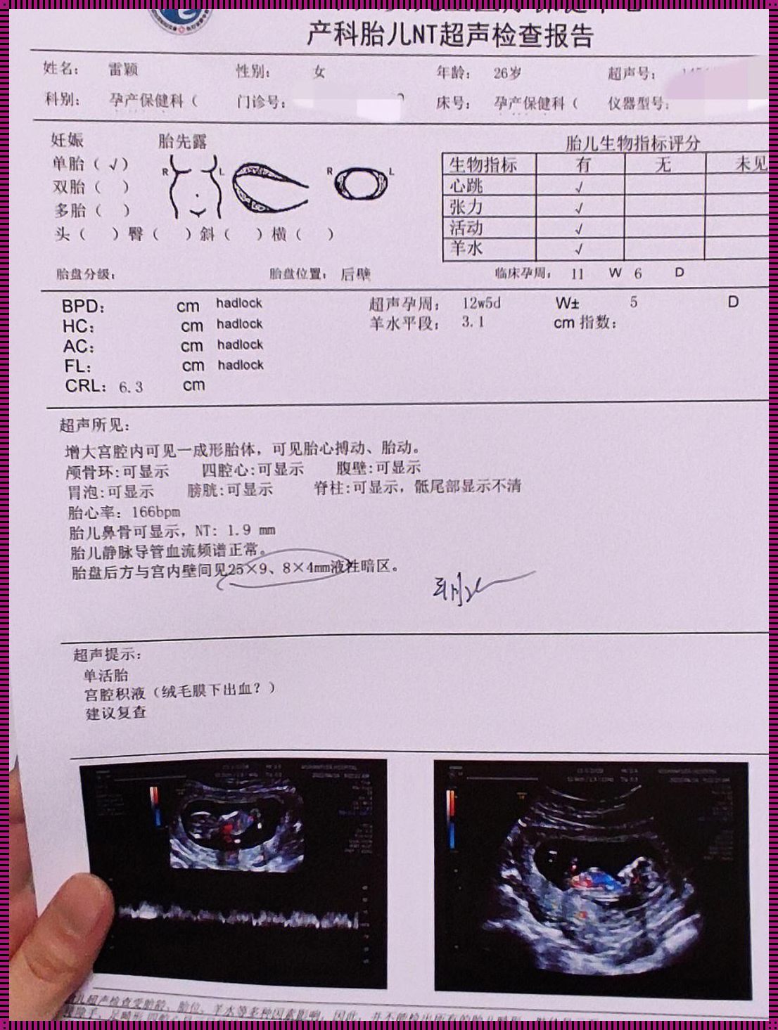 NT一次性过代表孩子很乖吗？